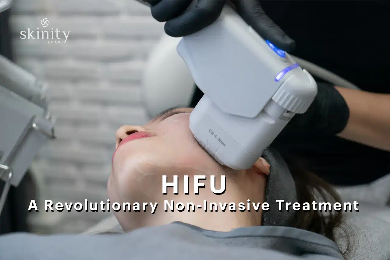 High-Intensity Focused Ultrasound (HIFU): A Revolutionary Non-Invasive Treatment