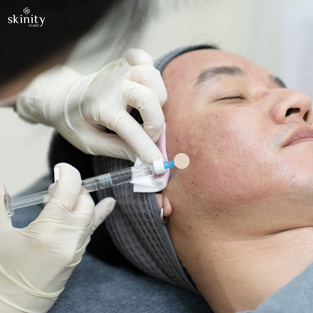 โปรแกรมรีจูรัน ต่างจาก การฉีดฟิลเลอร์ และเมโสเทราปีอย่างไร?