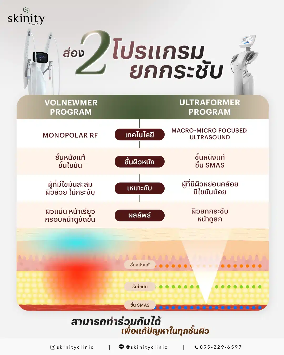 volnewmer vs ultraformer
