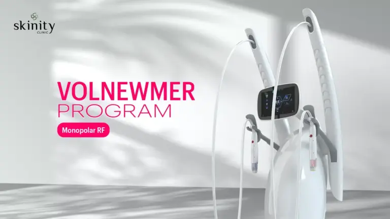 โปรแกรม Volnewmer