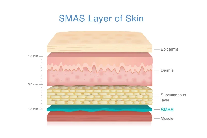 ผิวหนังชั้น SMAS